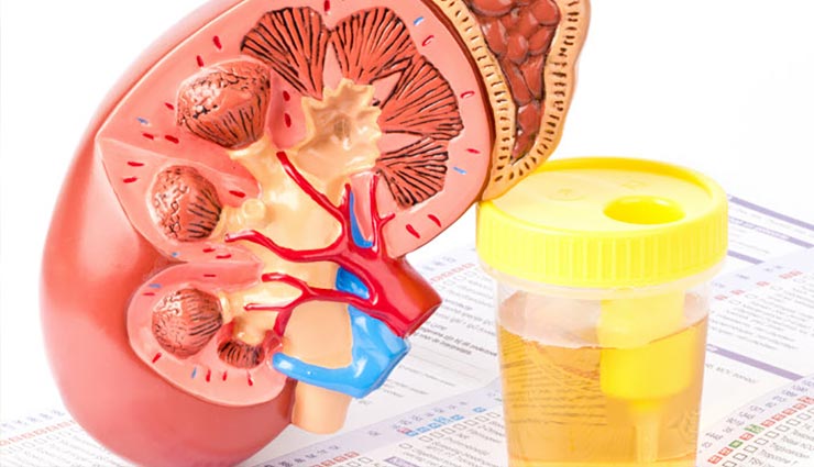 पेशाब के रंग से जानें कितने स्वस्थ है आप, बड़ी काम की है यह जानकारी