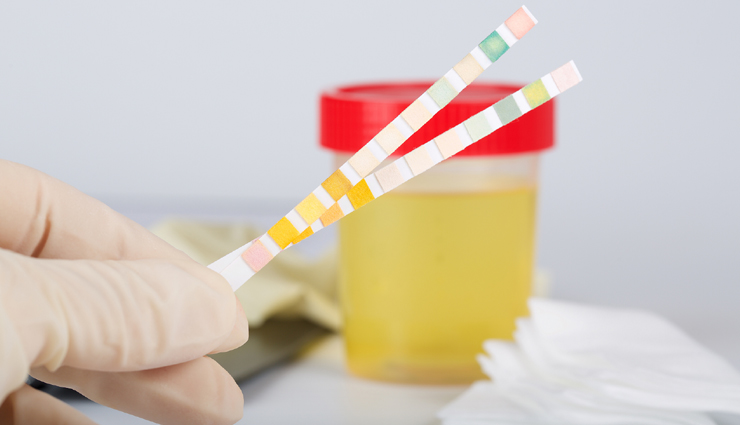 Pay Attention Before You Flush - Meaning of Your Urine Color