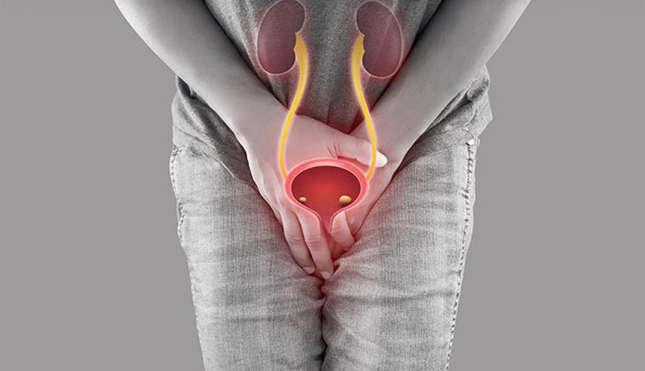 9 Effective Home Remedies To Treat Urine Infection