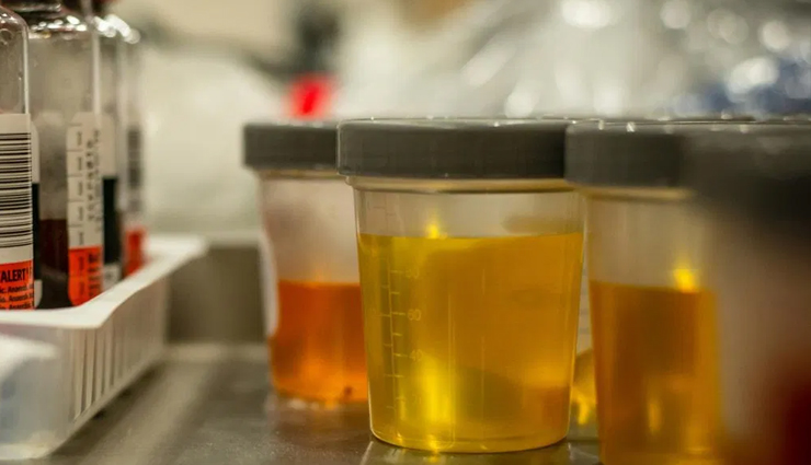 fascinating diseases that you can smell,diseases that you can smell,diabetic ketoacidosis,maple syrup urine disease,Migraine,arsenic poisoning,phenylketonuria,typhoid fever,narcolepsy,bacterial infection,schizophrenia,parkinsons disease,Health,Health tips