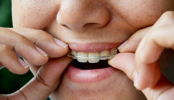 invisalign treatment,benefits of invisalign,invisalign braces,invisalign clear aligners,invisalign orthodontic treatment,invisalign for teeth alignment,invisalign vs traditional braces,how does invisalign work,invisalign process,invisalign consultation,invisalign maintenance,invisalign cleaning,invisalign cost,invisalign financing options,invisalign before and after,invisalign success stories,invisalign for adults,invisalign for teens,invisalign treatment tips