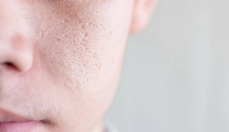 toner for reducing pore size,benefits of using toner,beauty tips,skin care tips