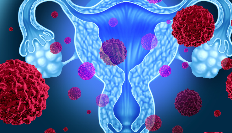 women reproductive health issues,common female health concerns,reproductive system problems in women,women health disorders,common gynecological issues,female reproductive health conditions,reproductive health challenges women,major women health concerns,female reproductive disorders,women health problems list