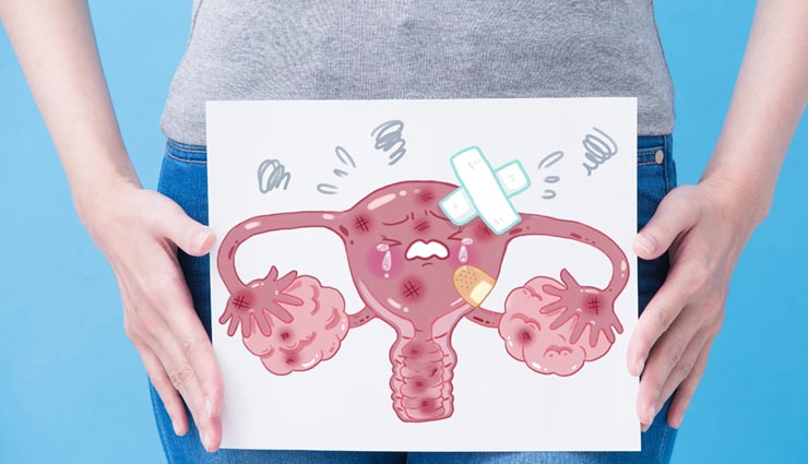 vaginal cancer,symptoms of vaginal cancer,causes of vaginal cancer,Health tips,fitness tips