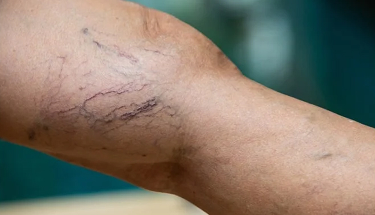 health benefits of walking daily,health benefits of walking,walking good exercise,lose excess weight,remain healthy,Health,Health tips