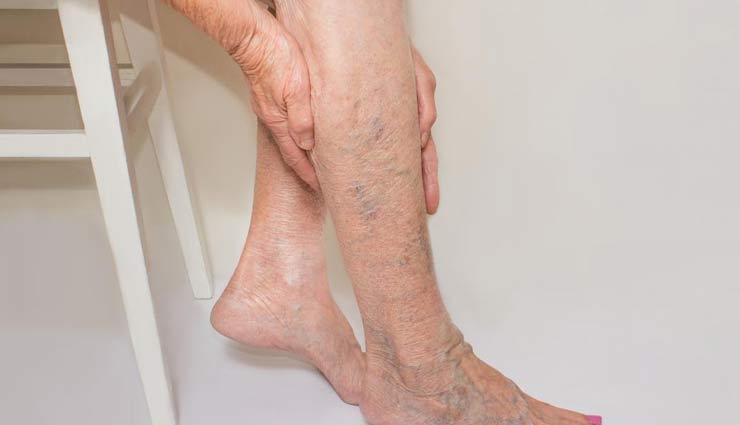 नसों की ब्लॉकेज को खोलने का काम करेंगे ये आहार, रोजाना करें इनका सेवन 