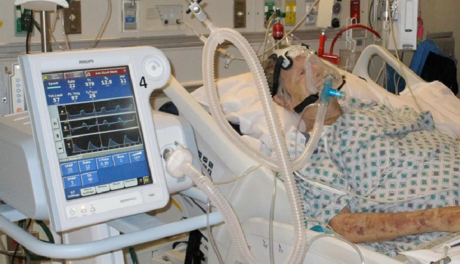 शरीर को कब पड़ती है वेंटिलेटर सपोर्ट की ज़रूरत? शुरुआती संकेत, खतरे और रिकवरी की पूरी जानकारी