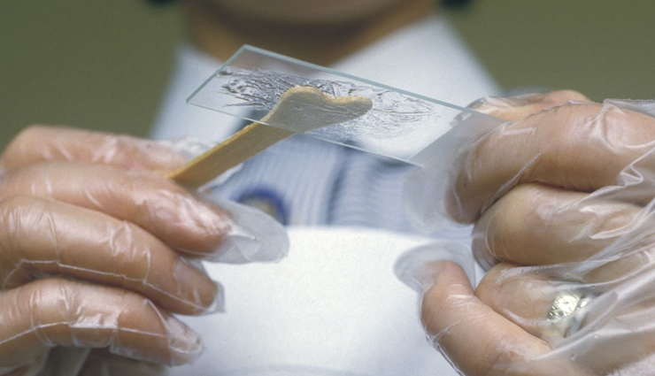 who can undergo cervical cancer screening,when should women get cervical cancer screening,cervical cancer,what is cervical cancer,Health,Health tips,health news