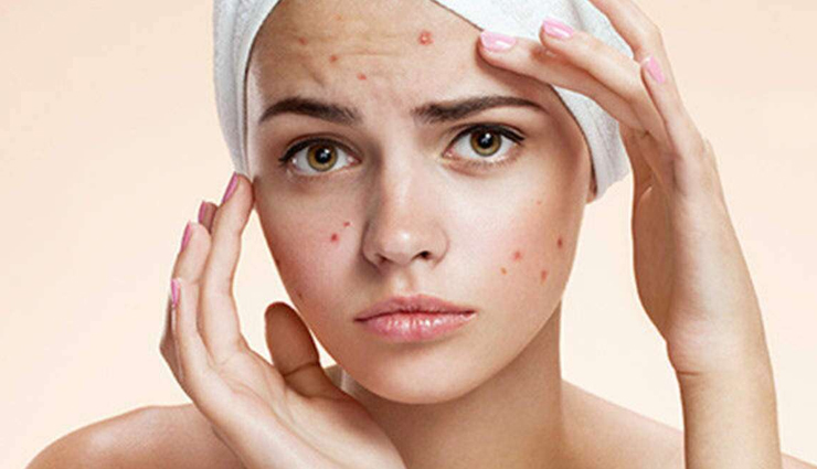 vinegar bath,beauty benefits of vinegar bath,skin care tips,beauty tips