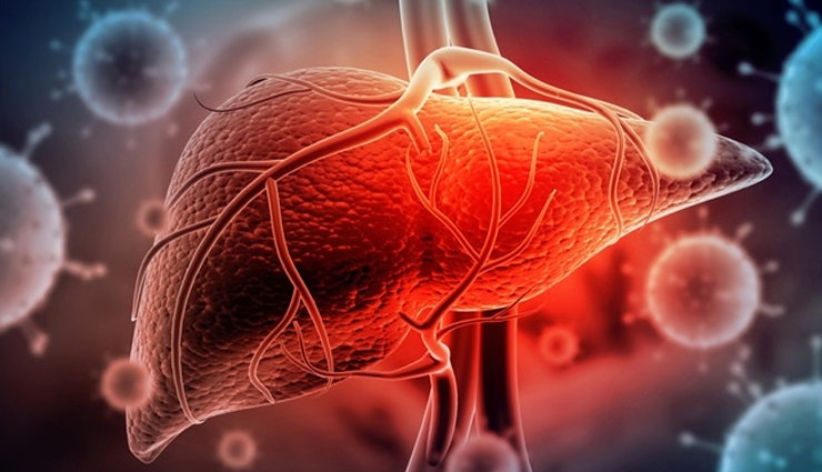 world liver day,fatty liver,causes of fatty liver,symptoms of fatty liver,home remedies for fatty liver,cure for fatty liver,non-alcoholic fatty liver disease nafld,alcoholic fatty liver disease afld,liver health,healthy liver,liver disease,obesity and liver health,diabetes and liver health,high cholesterol and liver health
