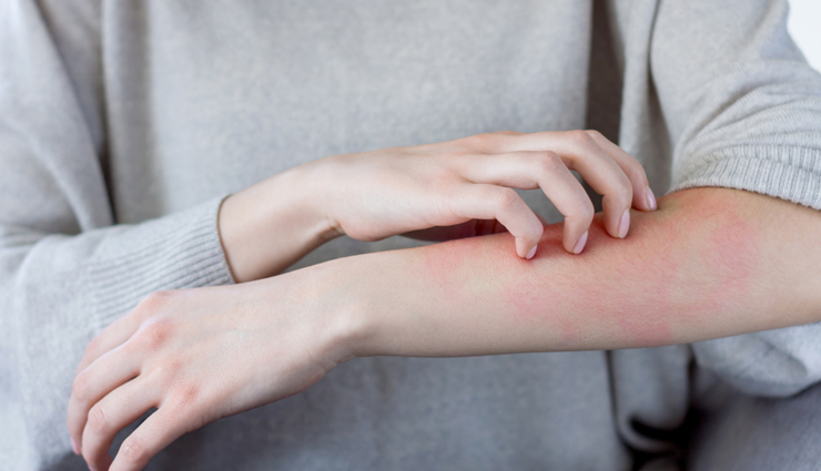 vitamin a,health benefits of vitamin a,vitamin a for your health,Health tips,fitness tips