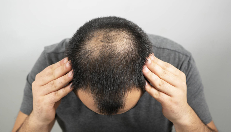 vitamin e capsules,beauty benefits of vitamin e capsules,beauty tips,skin care tips