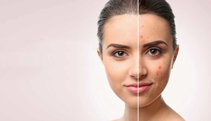 vitamin e for skin and hair,beauty benefits of vitamin e,skin care tips,beauty tips