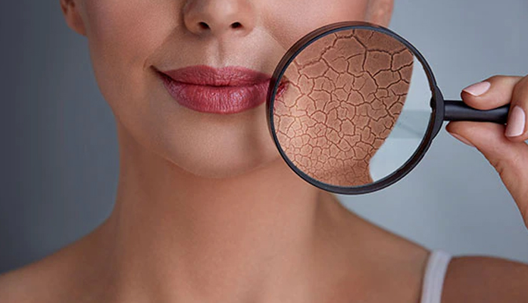 vitamin e capsules,beauty benefits of vitamin e capsules,beauty tips,skin care tips