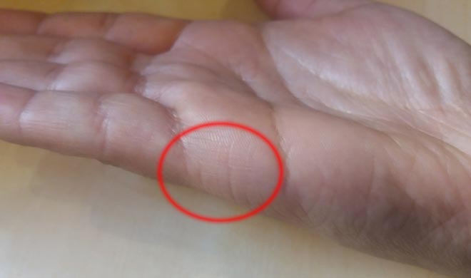 palmist,palm reading,wedding line