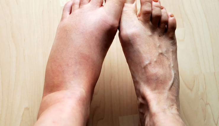 health benefits of walnuts,walnuts,Health tips,fitness tips