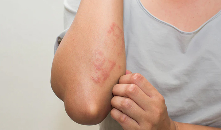 least known beauty benefits of walnuts,beauty tips,beauty hacks