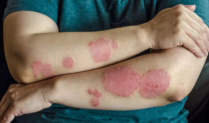 least known beauty benefits of walnuts,beauty tips,beauty hacks