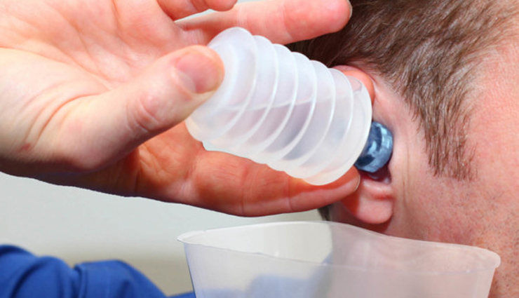 earwax,home remedies to get rid of earwax,earwax problem,earwax  treatment,ear care tips,Health,Health tips