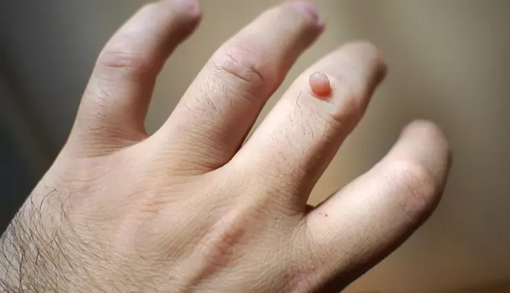 health benefits of banana peel,healthy living,Health tips