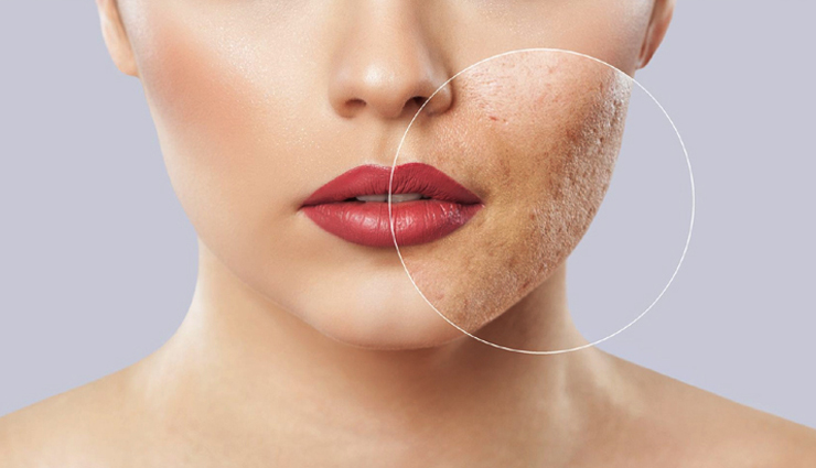 washing face with rice water,beauty benefits of rice water,skin care tips,beauty tips