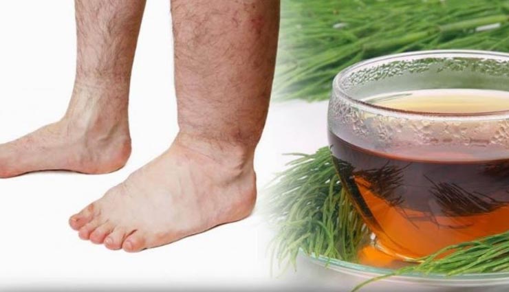 बेहद कष्टकारी हो सकती हैं वॉटर रिटेंशन की समस्या, लें इन घरेलू उपचारों की मदद Health tips,health tips in hindi,water retention,home remedies