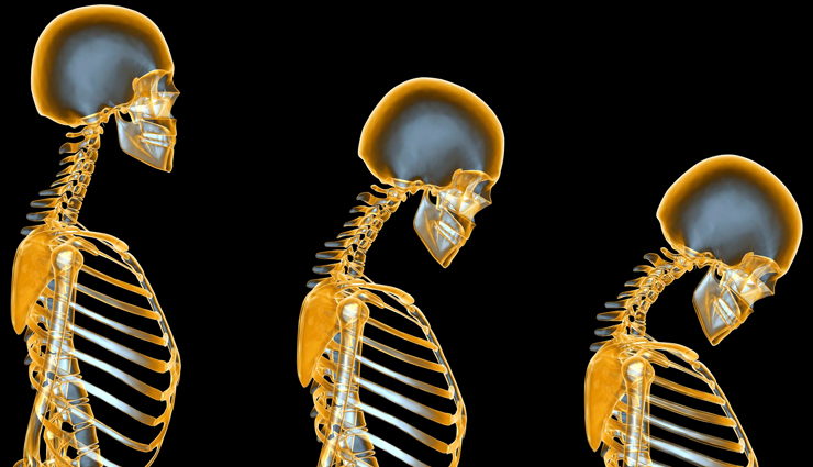 watermelon,health benefits of watermelon,Health tips,fitness tips