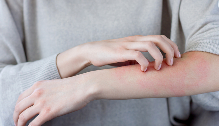 watermelon,health benefits of watermelon,Health tips,fitness tips