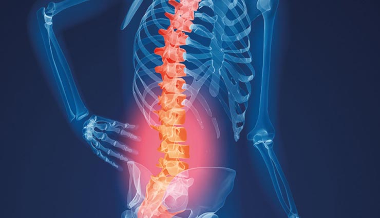 ये 5 चीजें कर रही है आपकी हड्डियों को खोखला, इनका सेवन बन सकता है आपके लिए दुखदायी