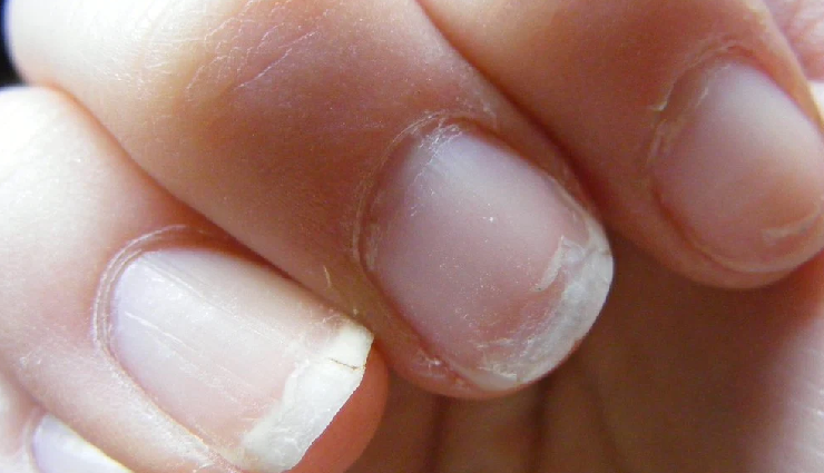 nail polish impact on nails,effects of wearing nail polish,nail polish consequences on nails,what happens to nails with nail polish,nail polish and nail health,nail polish damage to nails,nail enamel impact on nails,consequences of frequent nail polish use,nail polish side effects,nails after prolonged nail polish wear,long-term effects of nail lacquer,health risks of continuous nail polish application,nail polish wear and tear on nails,nail polish residue effects,nail health and polish use consequences