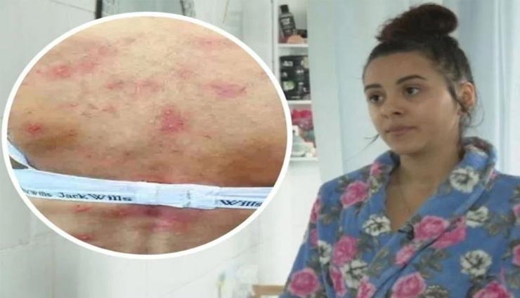 माँ बनने के बाद से ही महिला को हुई ये अनोखी बिमारी, दुनियाभर में केवल 40 लोग पीड़ित