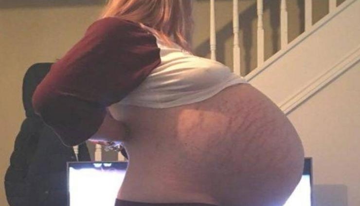 9 माह नहीं बल्कि तीन साल तक गर्भवती रही ये महिला, अल्ट्रासाउंड रिपोर्ट से हुआ असलियत का खुलासा