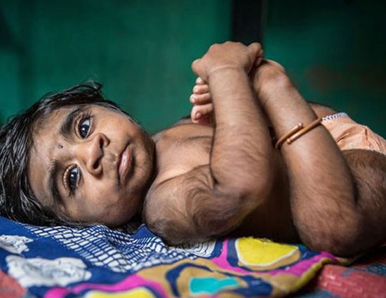 यह है वेयरवोल्फ बच्चा, देख चौक जाहेंगे आप 