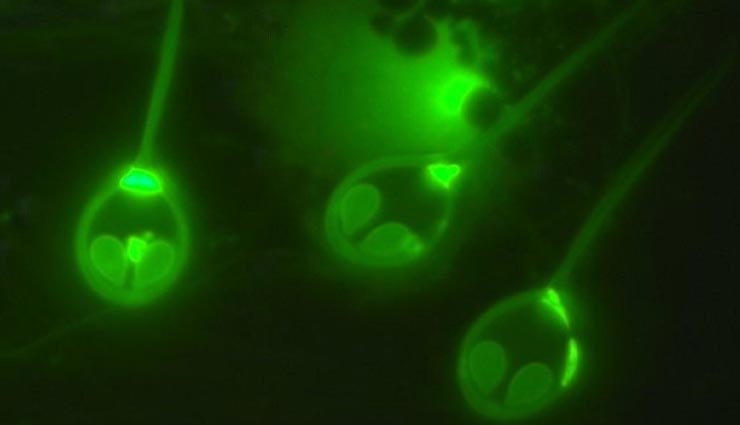 weird news,weird parasite,not need oxygen to survive,israel scientists