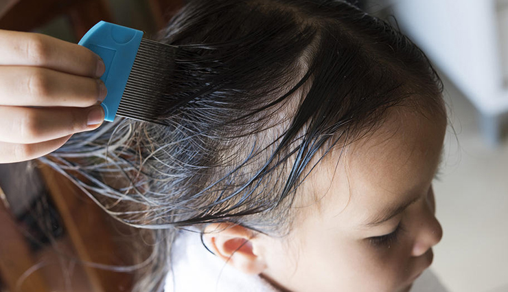 head lice,home remedies to get rid of head lice,lice problem,scalp care tips,scalp care,beauty,beauty tips