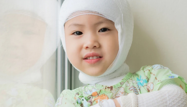 remedies to treat eczema in babies naturally,treat eczema in babies,healthy living,Health tips,infection in babies