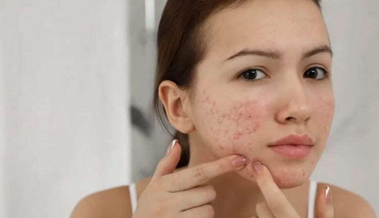 wheat germ oil,beauty benefits of wheat germ oil,wheat germ oil for skin,sin care tips,beauty tips