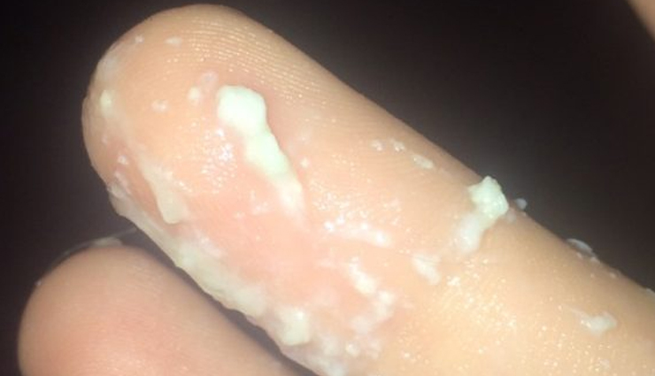 essential facts about vaginal discharge every woman should know,understanding vaginal discharge: key information for women,vaginal discharge facts all women should be aware of,important insights into vaginal discharge for women,what every woman should know about vaginal discharge,facts and information about normal vaginal discharge,exploring the facts about vaginal discharge in women,vaginal discharge: important facts and considerations for women,key things to know about vaginal discharge in females,educating women about the facts of vaginal discharge