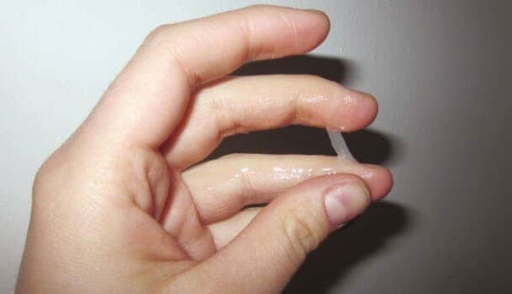 white discharge during pregnancy,types of vaginal discharge in pregnancy,pregnancy discharge guide,vaginal secretions during gestation,clear white discharge in pregnancy,milky white discharge during gestation,thick white discharge while pregnant,watery white discharge in pregnancy,normal vaginal discharge during pregnancy,abnormal discharge warning signs,pregnancy vaginal health,discharge changes and pregnancy health,managing discharge discomfort in pregnancy,pregnancy discharge care tips,maintaining vaginal hygiene during gestation,comfortable pregnancy discharge wear,infection risk and pregnancy discharge,abnormal discharge causes in pregnancy,seeking medical advice for discharge concerns,discharge and pregnancy complications