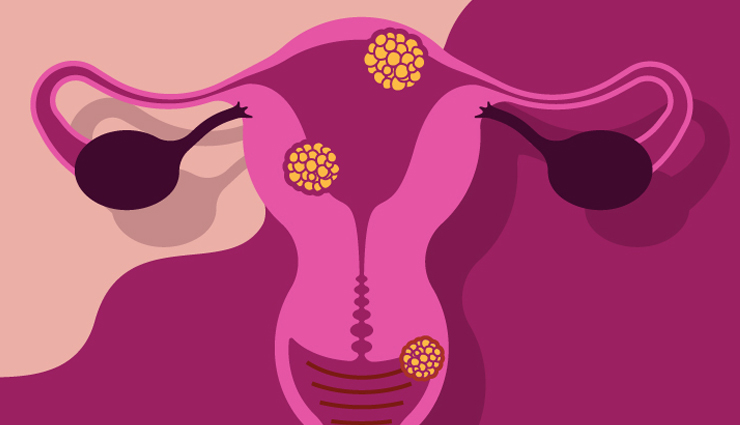 white discharge during pregnancy,types of vaginal discharge in pregnancy,pregnancy discharge guide,vaginal secretions during gestation,clear white discharge in pregnancy,milky white discharge during gestation,thick white discharge while pregnant,watery white discharge in pregnancy,normal vaginal discharge during pregnancy,abnormal discharge warning signs,pregnancy vaginal health,discharge changes and pregnancy health,managing discharge discomfort in pregnancy,pregnancy discharge care tips,maintaining vaginal hygiene during gestation,comfortable pregnancy discharge wear,infection risk and pregnancy discharge,abnormal discharge causes in pregnancy,seeking medical advice for discharge concerns,discharge and pregnancy complications