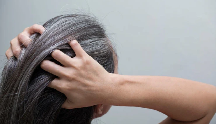 10 Effective Home Remedies To Treat White Hair