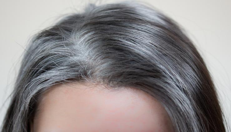 सफ़ेद बाल बन रहे हैं समस्या, इन उपायों की मदद से पाए राहत