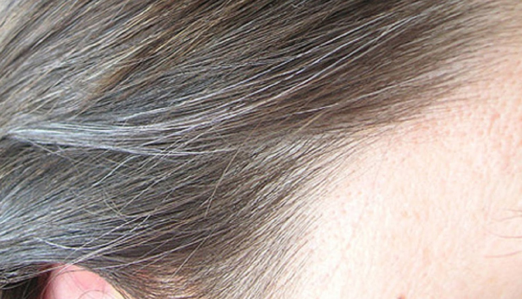 5 Home Remedies To Get Rid of White Hair 