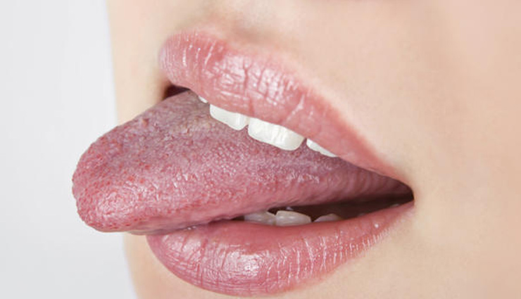 home remedies for white tongue,home remedies,mouth home remedies,mouth cleaning tips,tongue cleaning tips,Health tips