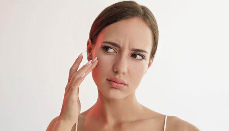 5 Natural Ways To Get Rid of Whiteheads