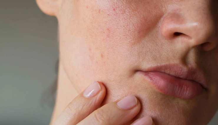 wild lettuce,side effects of wild lettuce,Health tips,fitness tips