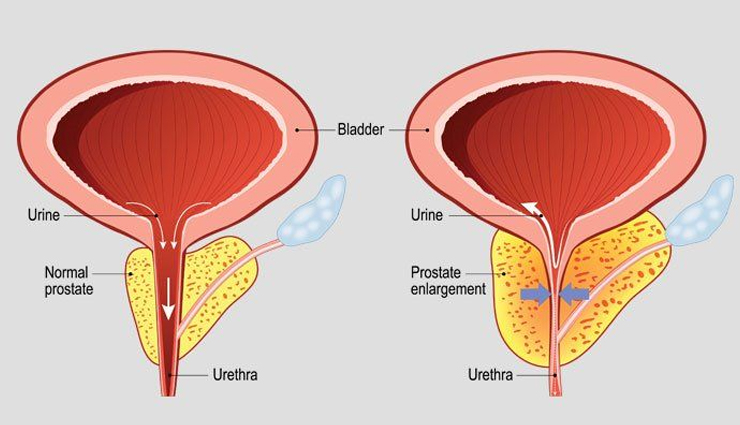 wild lettuce,side effects of wild lettuce,Health tips,fitness tips