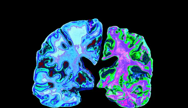 health benefits of drinking wine,wine,wine benefits,Health tips,fitness tips