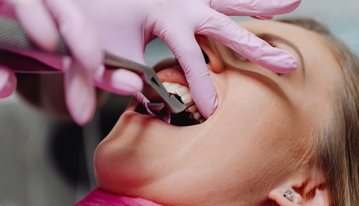 wisdom teeth extraction procedure,preparing for wisdom teeth removal,recovery after wisdom teeth removal,wisdom teeth removal pain management,risks of wisdom teeth extraction,cost of wisdom teeth removal,aftercare for wisdom teeth removal,complications of wisdom teeth removal,common questions about wisdom teeth extraction,benefits of wisdom teeth removal,alternatives to wisdom teeth extraction,impacted wisdom teeth and their removal,wisdom teeth removal for crowded teeth,wisdom teeth removal for orthodontic reasons,surgical and non-surgical wisdom teeth extraction