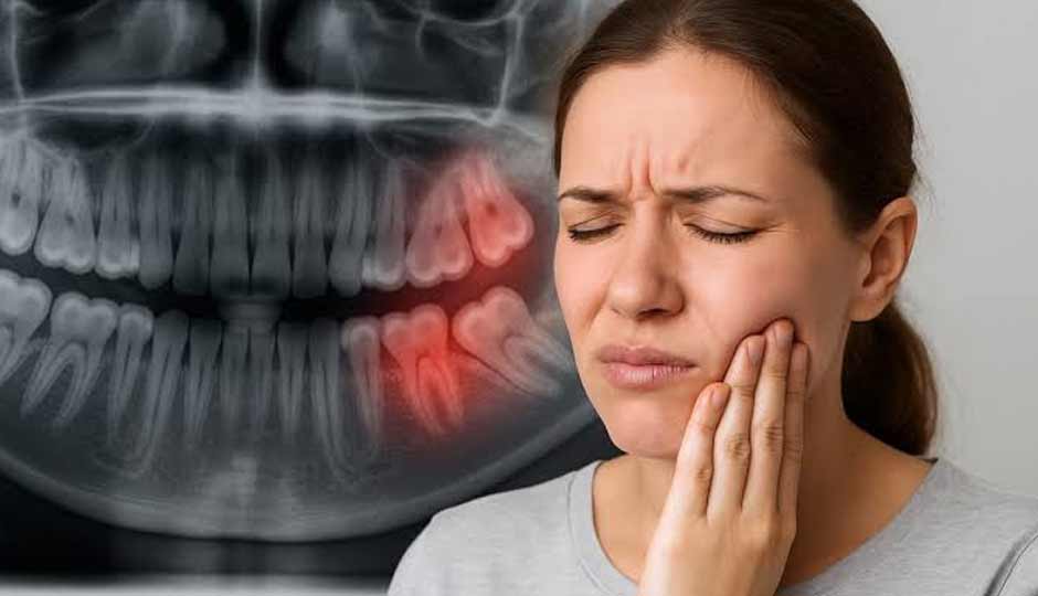 10 Home Remedies To Help You Get Relief from Wisdom Tooth Pain